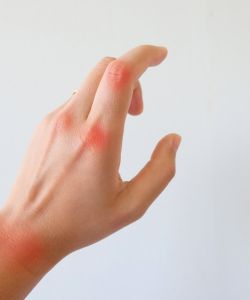 blog artritis 002